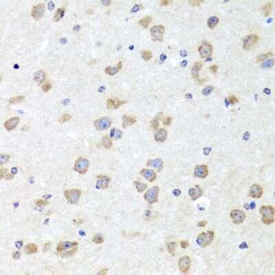 Immunohistochemistry-Paraffin: CHD1 Antibody - BSA Free [NBP3-02966]