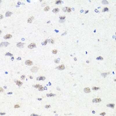 Immunohistochemistry-Paraffin: CHD1 Antibody - BSA Free [NBP3-02966]