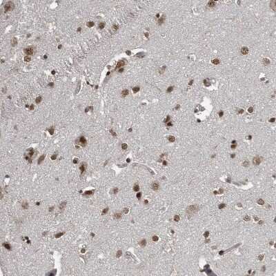Immunohistochemistry-Paraffin: CHD1L Antibody [NBP1-89153]