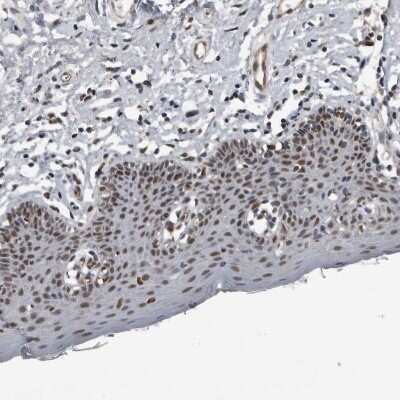 Immunohistochemistry-Paraffin: CHD1L Antibody [NBP1-89153]