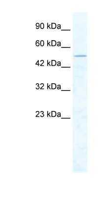 Western Blot: CHD1L Antibody [NBP1-57105]