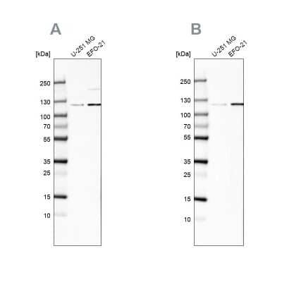 Western Blot: CHD1L Antibody [NBP1-89153]