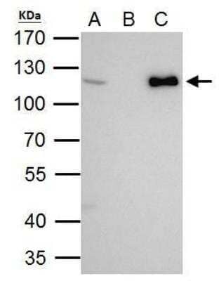 Western Blot: CHD1L Antibody [NBP2-59305]