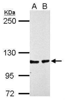 Western Blot: CHD1L Antibody [NBP2-59305]