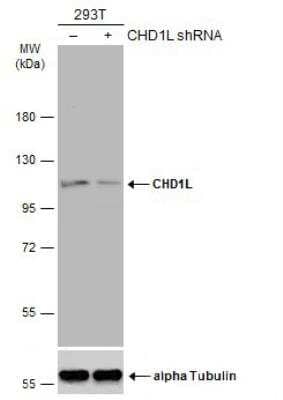 Western Blot: CHD1L Antibody [NBP2-59305]