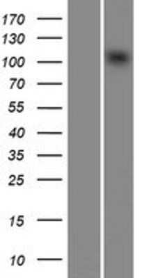 Western Blot: CHD1L Overexpression Lysate [NBP2-07889]