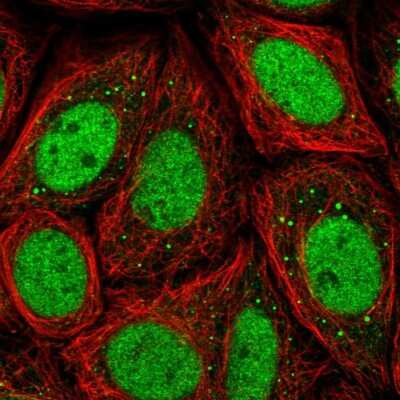 Immunocytochemistry/ Immunofluorescence: CHD2 Antibody [NBP2-32577]