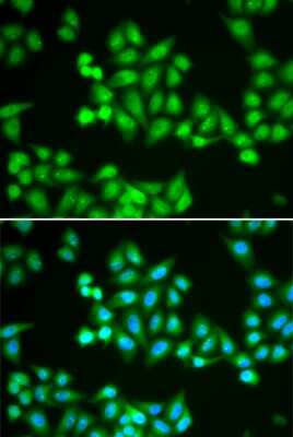 Immunocytochemistry/ Immunofluorescence: CHD2 Antibody - BSA Free [NBP3-04885]