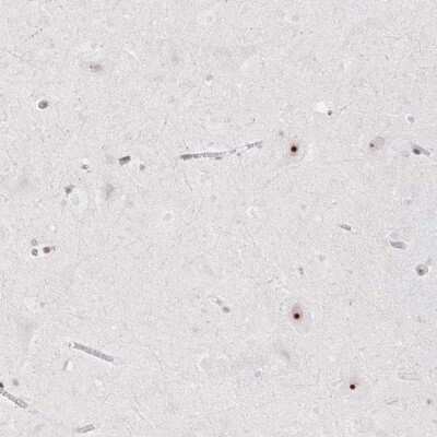 Immunohistochemistry-Paraffin: CHD2 Antibody [NBP2-32577]