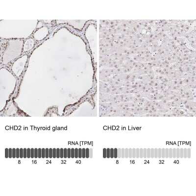 Immunohistochemistry-Paraffin: CHD2 Antibody [NBP2-32563]