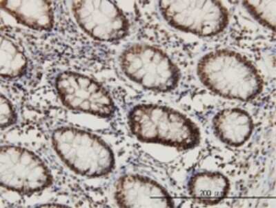 Immunohistochemistry-Paraffin: CHD3 Antibody (5E12) [H00001107-M01]