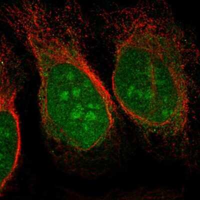 Immunocytochemistry/ Immunofluorescence: CHD3 Antibody [NBP2-57564]