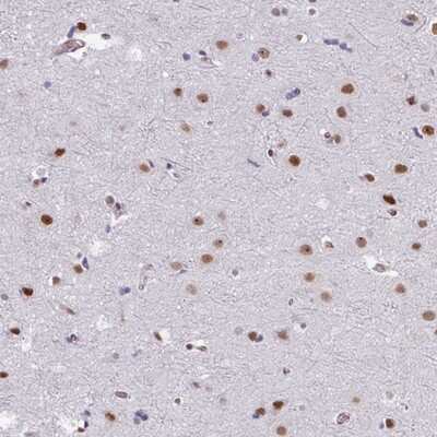 Immunohistochemistry-Paraffin: CHD3 Antibody [NBP2-14479]