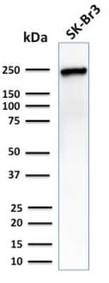 Western Blot: CHD4 Antibody (3F2/4)Azide and BSA Free [NBP3-08830]