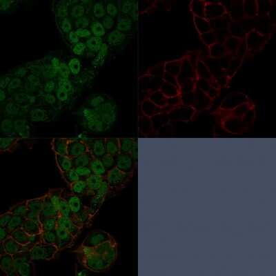 Immunocytochemistry/ Immunofluorescence: CHD4 Antibody (3F2/4) [NBP3-07505]