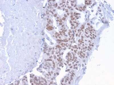 Immunohistochemistry-Paraffin: CHD4 Antibody (3F2/4) [NBP3-07505]