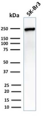 Western Blot: CHD4 Antibody (3F2/4) [NBP3-07505]