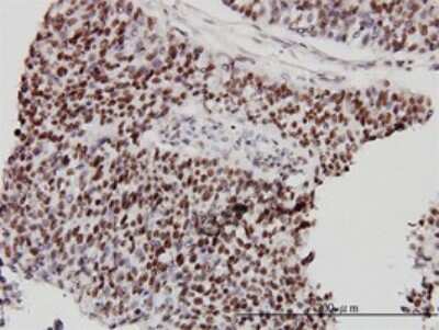 Immunohistochemistry-Paraffin: CHD4 Antibody (4H4) [H00001108-M01]