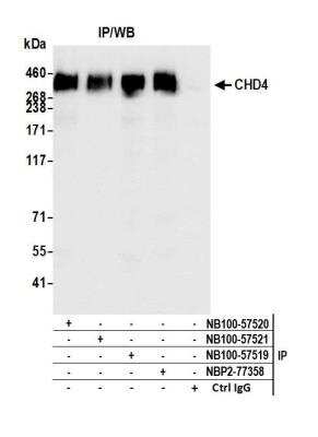 Immunoprecipitation: CHD4 Antibody (BLR066G) [NBP2-77358]