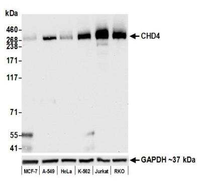 Western Blot: CHD4 Antibody (BLR066G) [NBP2-77358]