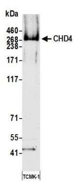 Western Blot: CHD4 Antibody (BLR066G) [NBP2-77358]