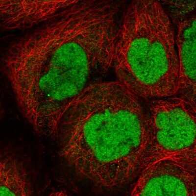 Immunocytochemistry/ Immunofluorescence: CHD4 Antibody [NBP1-82651]