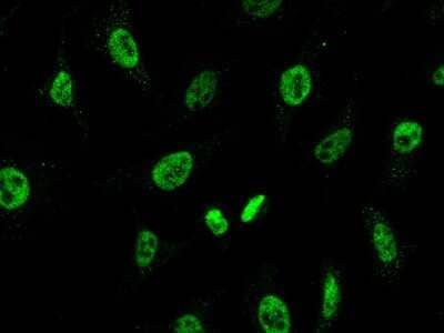 Immunocytochemistry/ Immunofluorescence: CHD4 Antibody [NBP2-99098]