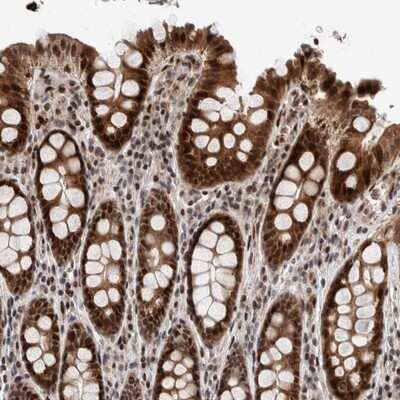 Immunohistochemistry-Paraffin: CHD4 Antibody [NBP1-82651]