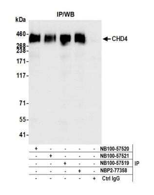 Immunoprecipitation: CHD4 Antibody [NB100-57519]