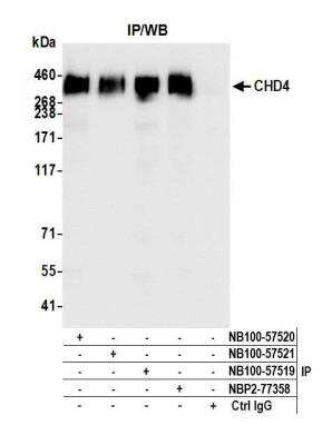 Immunoprecipitation: CHD4 Antibody [NB100-57521]