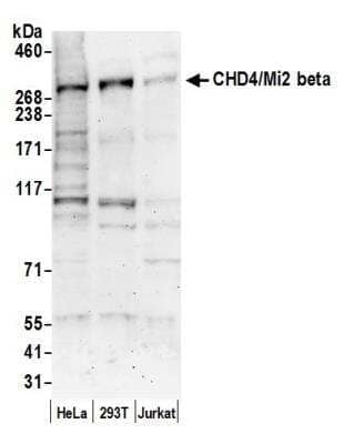 Western Blot: CHD4 Antibody [NB100-57519]