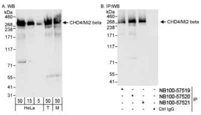 Western Blot: CHD4 Antibody [NB100-57520]