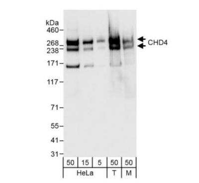 Western Blot: CHD4 Antibody [NB100-57521]