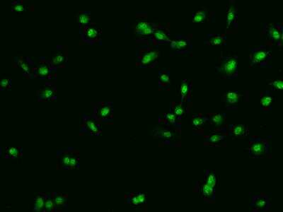 Immunocytochemistry/ Immunofluorescence: CHD5 Antibody [NBP3-06267]