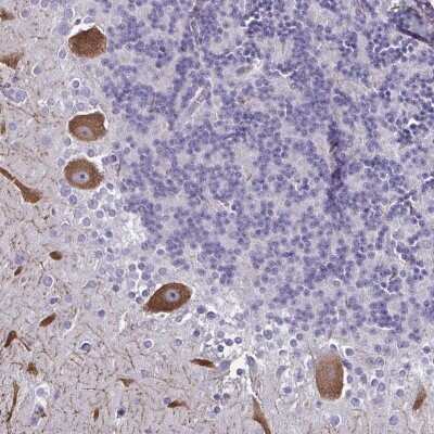 Immunohistochemistry: CHD5 Antibody [NBP2-49186]