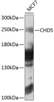 Western Blot: CHD5 AntibodyBSA Free [NBP2-92563]