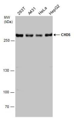 Western Blot: CHD5 Antibody [NBP3-12985]