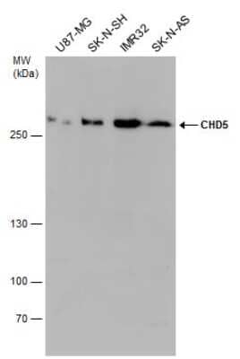 Western Blot: CHD5 Antibody [NBP3-12985]