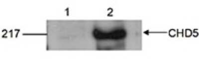 Western Blot: CHD5 Antibody [NBP3-18636]