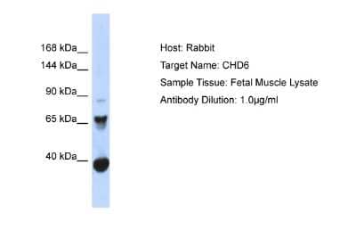 Western Blot: CHD6 Antibody [NBP2-83972]