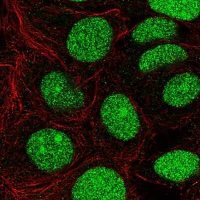 Immunocytochemistry/ Immunofluorescence: CHD7 Antibody [NBP2-55672]