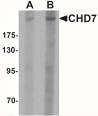 Western Blot: CHD7 AntibodyBSA Free [NBP2-41133]