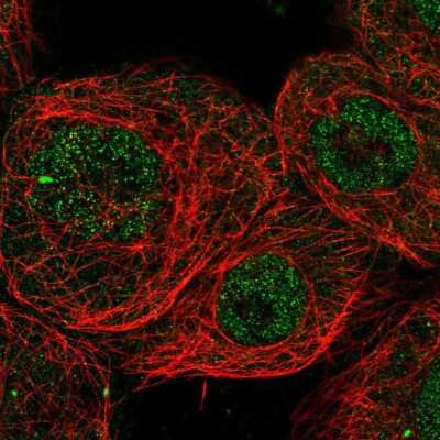 Immunocytochemistry/ Immunofluorescence: CHD8 Antibody [NBP2-58582]