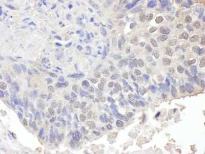 Immunohistochemistry-Paraffin: CHD8 Antibody [NB100-60417]