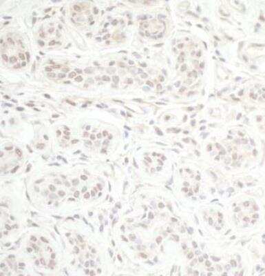 Immunohistochemistry-Paraffin: CHD8 Antibody [NB100-60418]