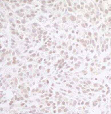Immunohistochemistry-Paraffin: CHD8 Antibody [NB100-60418]