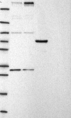 Western Blot: CHD8 Antibody [NBP3-17355]