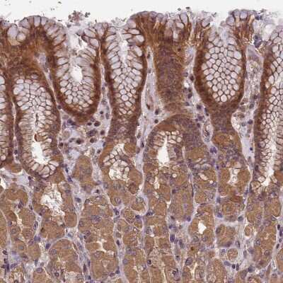 Immunohistochemistry-Paraffin: CHD9 Antibody [NBP2-48758]