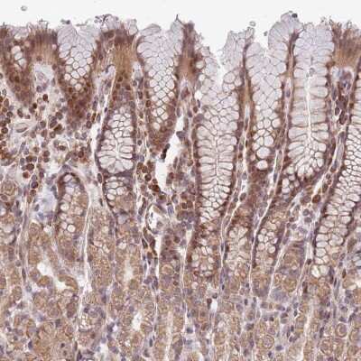 Immunohistochemistry-Paraffin: CHD9 Antibody [NBP2-48933]