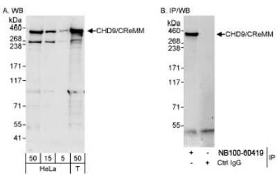 Western Blot: CHD9 Antibody [NB100-60419]